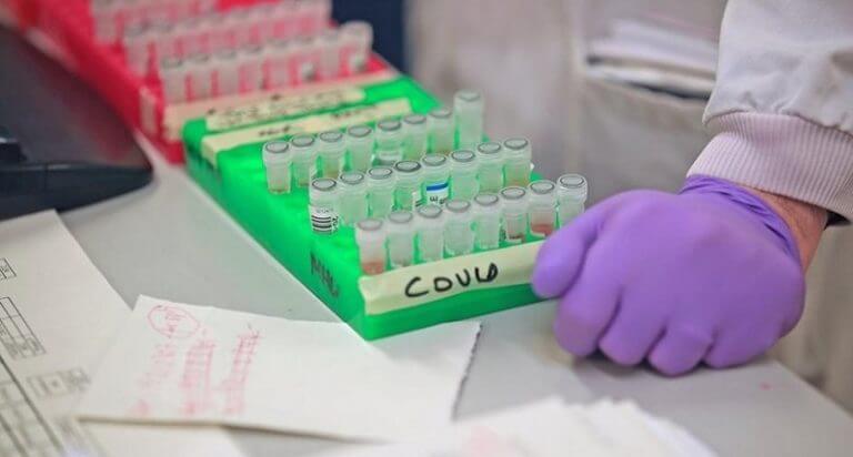 test covid1