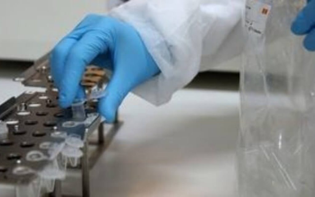 covid analiseis limata