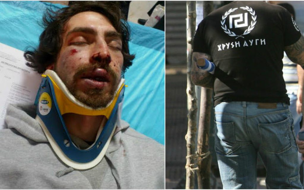 foititis xa