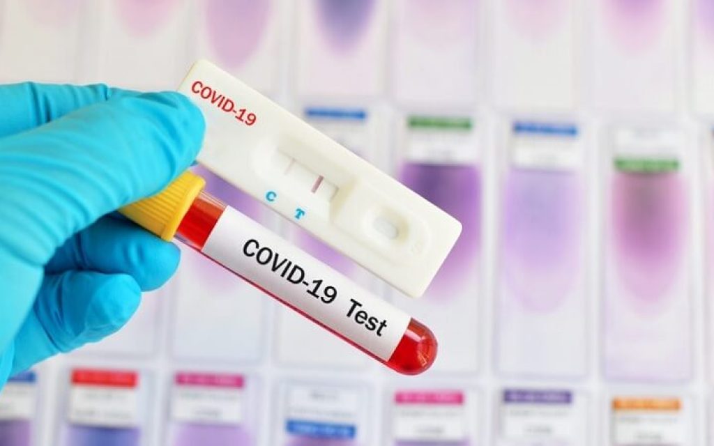koronovirus test