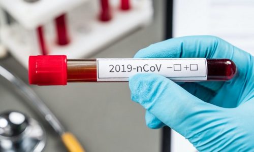 Nurse hand fills out a medical form Coronavirus test on hospital table with respiratory mask and test tubes with blood for analysis. 2019-nCoV virus infection originating in Wuhan, China